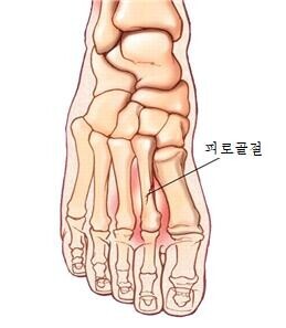 thumbimg